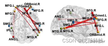 FNIRS功能近紅外數(shù)據處理服務